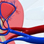 Hypertension