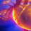 Tall Rounds®           Imaging Chest Pain: New Guidelines and New Era?